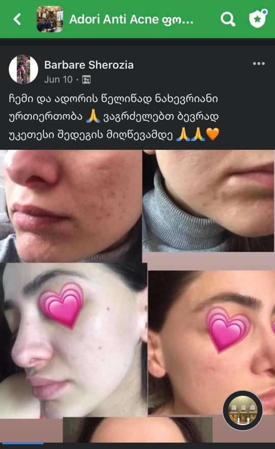 ადორით 18 თვიანი მკურნალობის შედეგი